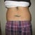 Smart Lipo Community Photo